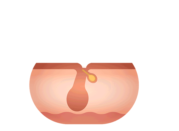 リリィジュRICHでイキイキとしたボリューム髪に